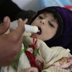 7 million Yemenis was close to dying from hunger
